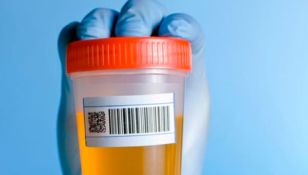 Urinanalyse